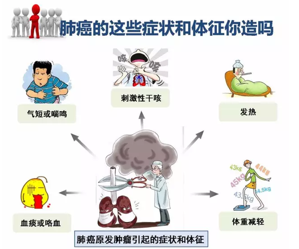 郑州市治疗肺癌医馆