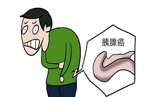 郑州肿瘤科医馆中医师详解:胰腺癌是什么原因引起的