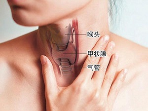 郑州肿瘤中医师王卫昌浅析:甲状腺癌的预防措施